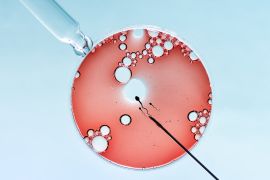 خطوات التلقيح الاصطناعي (أطفال الأنابيب) In vitro Fertilisation IVF