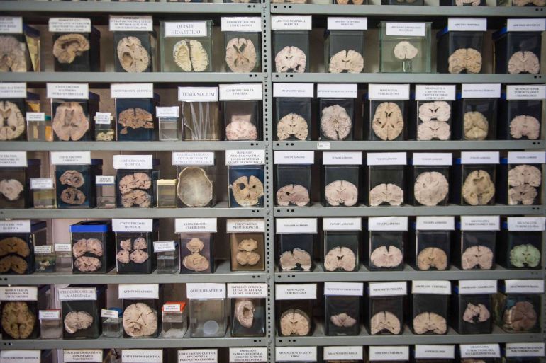 A collection of sick human brains is displayed at the "Museum of Neuropathology" in Lima on November 16, 2016. The "Museum of Neuropathology" at the Santo Toribio de Mogrovejo hospital bears a collection of 290 brains and offers an unusual journey by encephalic masses unrevealing the secrets of the most complex organ of the human body.