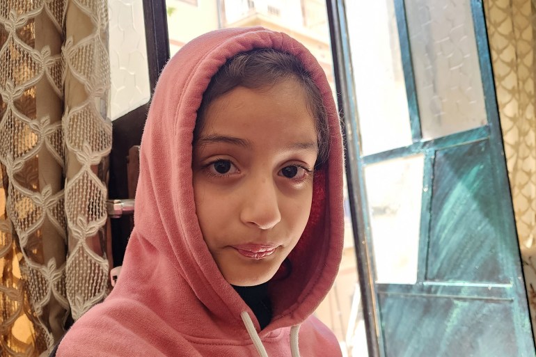 فلسطين- رام الله- عزيزة نوفل- ريتاج 10 سنوات وشقيقتها ريتال كن الأقرب إلى مكان الحريق في المنزل - الجزيرة نت