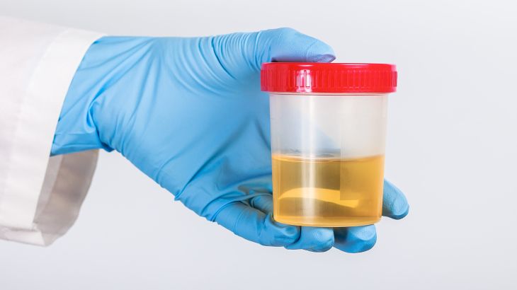 لون البول بول test tube with a urine test in the doctor's gloved hand; Shutterstock ID 1704069631; purchase_order: multimedia; job: ; client: ; other: