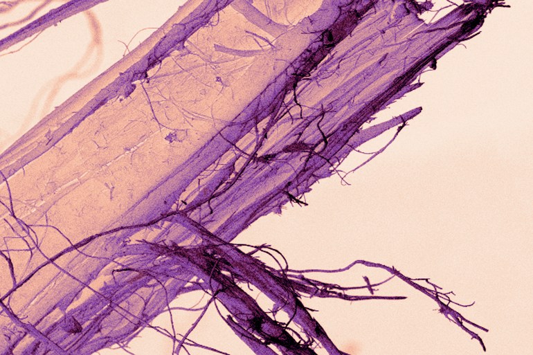 Scanning Electron micrograph of asbestos