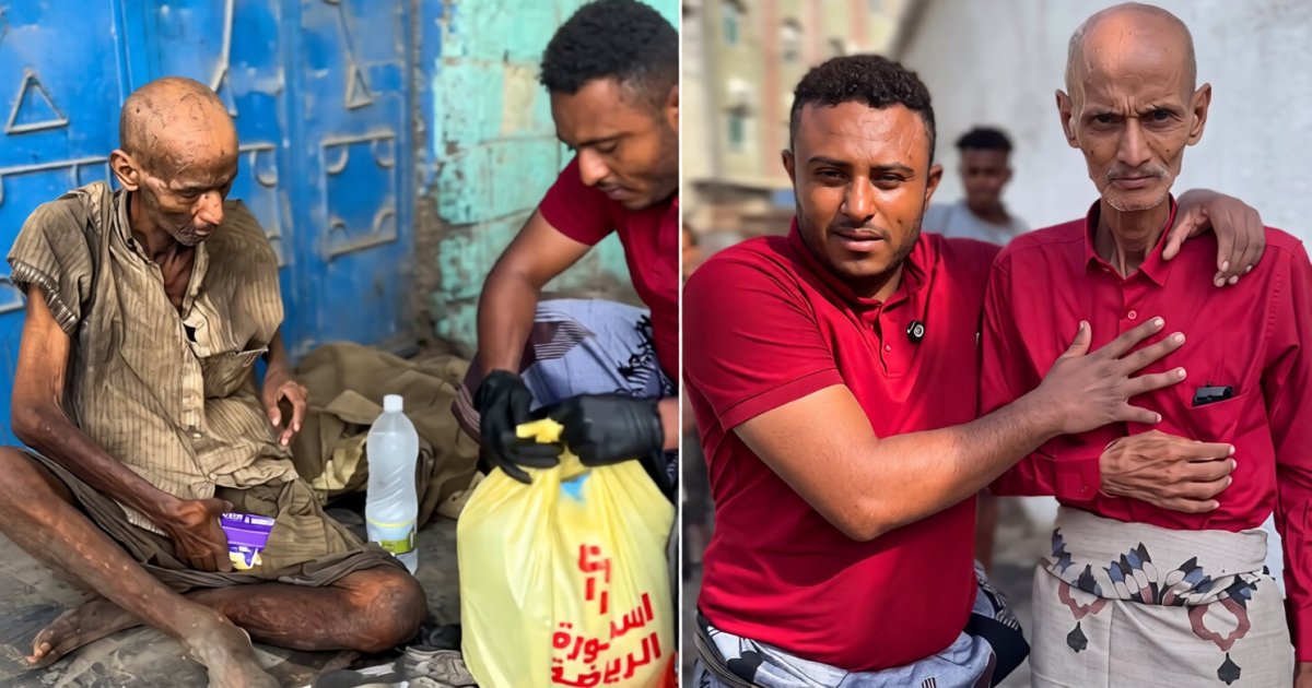 "لم يبقَ منه إلا العظام".. ناشط يمني يوثق مأساة طبيب مصري مشرد في الحديدة.