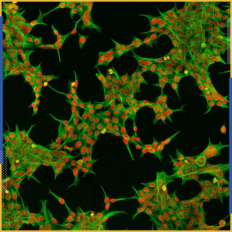 صورة مجهرية لخلايا الكلى الجنينية البشرية - المصدر